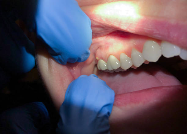Best Cracked Tooth Emergency Dentist  in Lac Du Flambeau, WI